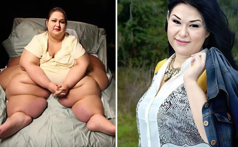 Ważyła ponad 470 kg, nie mogła się ruszać, została niesłusznie oskarżona o morderstwo… Dziś jest nie do poznania